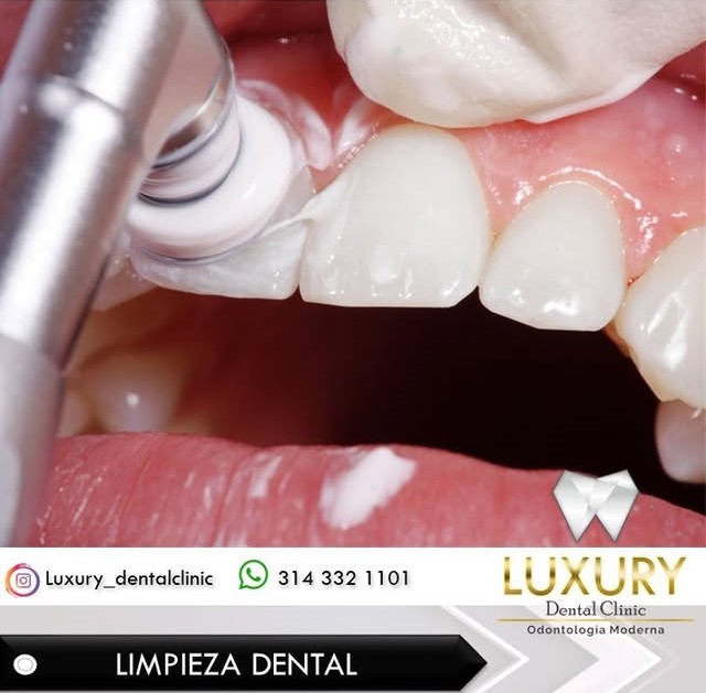 Limpieza Dental